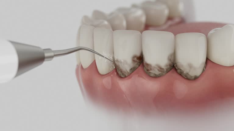 Reliable Emergency Dentist contractor in Evendale, OH by Smile Center Dentistry